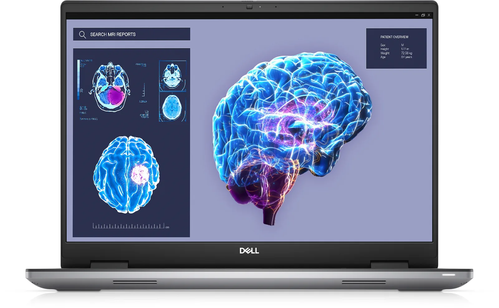DELL Precision 7680 31P9V